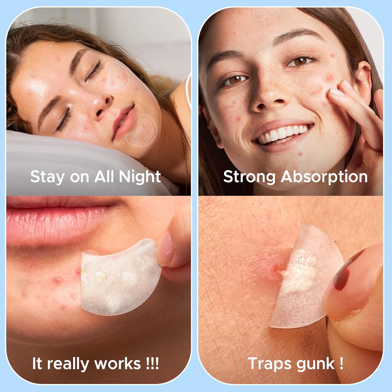 LitBear Pimple Patches for Face, Large Acne Patch, XL Hydrocolloid Bandages,Zit Stickers for Forehead, Chin, Nose, Body, Back, and Chest (5 Sizes, 228 Pimple Patches)